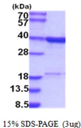Human RPRD1B protein, His tag. GTX68672-pro
