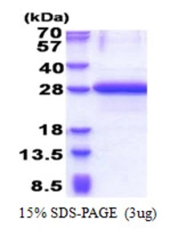 Human OBFC2A protein, His tag. GTX68706-pro