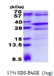 Human RSG1 protein, His tag. GTX68729-pro