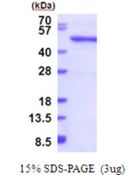 Human QTRTD1 protein, His tag. GTX68741-pro