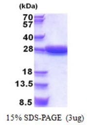 Human STARD5 protein, His tag. GTX68760-pro