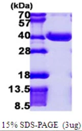 Human NPL protein, His tag. GTX68766-pro