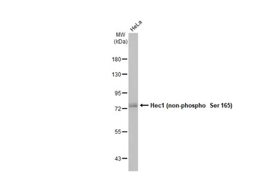 Anti-Hec1 (non-phospho Ser 165) antibody used in Western Blot (WB). GTX70012
