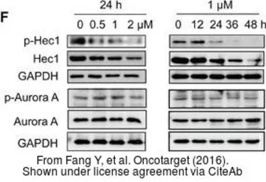 Anti-Hec1 (phospho Ser 165) antibody used in Western Blot (WB). GTX70013