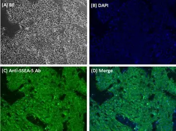 Anti-SSEA-5 antibody [8e11] used in Immunocytochemistry/ Immunofluorescence (ICC/IF). GTX70019