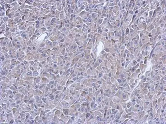 Anti-ATM antibody [3E8] used in IHC (Paraffin sections) (IHC-P). GTX70105
