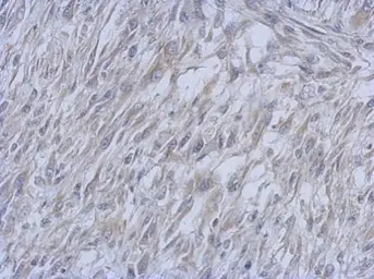 Anti-ATM antibody [3E8] used in IHC (Paraffin sections) (IHC-P). GTX70105