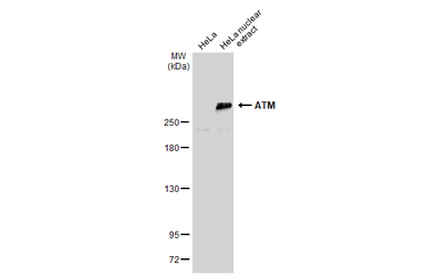 Anti-ATM antibody [3E8] used in Western Blot (WB). GTX70105