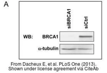Anti-BRCA1 antibody [8F7] used in Western Blot (WB). GTX70113
