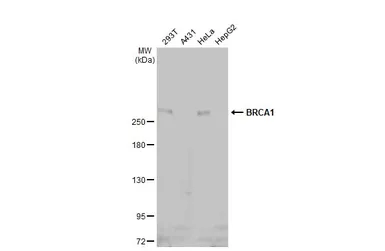 Anti-BRCA1 antibody [8F7] used in Western Blot (WB). GTX70113
