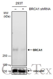 Anti-BRCA1 antibody [6B4] - ChIP grade used in Western Blot (WB). GTX70115