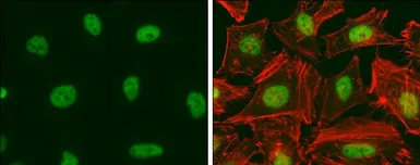 Anti-E2F1 antibody [16G7] used in Immunocytochemistry/ Immunofluorescence (ICC/IF). GTX70163