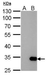Anti-GST tag antibody [3G10] used in Western Blot (WB). GTX70195