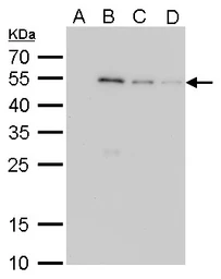 Anti-GST tag antibody [3G10] used in Western Blot (WB). GTX70195