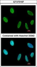 Anti-SAFB antibody [6F7] used in Immunocytochemistry/ Immunofluorescence (ICC/IF). GTX70197