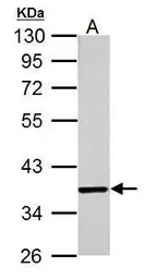 Anti-Jab1 antibody [2A10.8] used in Western Blot (WB). GTX70203