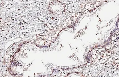 Anti-p53 antibody [DO1] used in IHC (Paraffin sections) (IHC-P). GTX70214