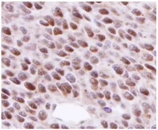 Anti-Rad51 antibody [14B4] used in IHC (Paraffin sections) (IHC-P). GTX70230