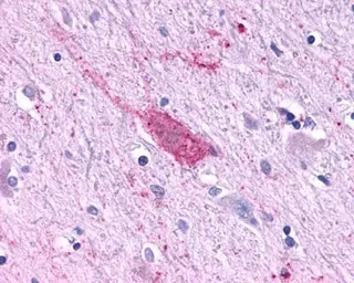 Anti-RbAp48 antibody [11G10] used in Immunohistochemistry (IHC). GTX70232