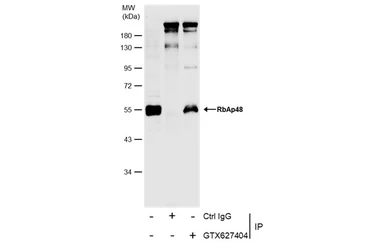 Anti-RbAp48 antibody [13D10] used in Immunoprecipitation (IP). GTX70234