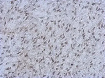 Anti-RbAp48 + RbAp46 antibody [15G12] used in IHC (Paraffin sections) (IHC-P). GTX70236