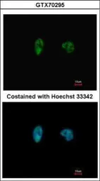 Anti-Chk2 antibody [8F12] used in Immunocytochemistry/ Immunofluorescence (ICC/IF). GTX70295