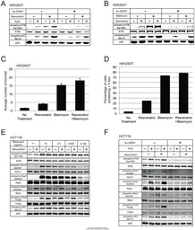 Anti-Chk2 antibody [8F12] used in Western Blot (WB). GTX70295