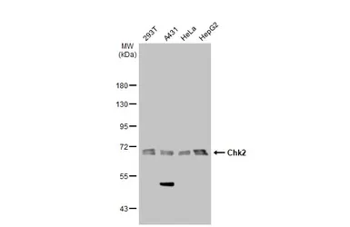 Anti-Chk2 antibody [8F12] used in Western Blot (WB). GTX70295