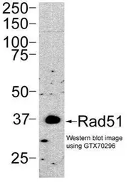 Anti-Rad51 antibody [13E4] used in Western Blot (WB). GTX70296