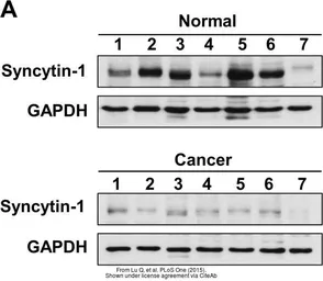 Anti-Human Endogenous Retrovirus antibody used in Western Blot (WB). GTX70327