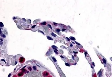Anti-CCR1 antibody used in IHC (Paraffin sections) (IHC-P). GTX70509