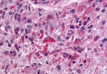 Anti-GPR64 antibody used in IHC (Paraffin sections) (IHC-P). GTX70515