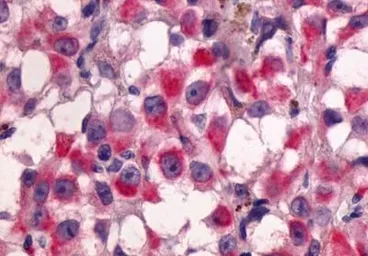 Anti-GPR64 antibody used in IHC (Paraffin sections) (IHC-P). GTX70515