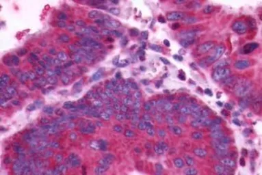 Anti-CXCR4 antibody used in IHC (Paraffin sections) (IHC-P). GTX70531