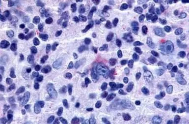 Anti-GPR65 antibody used in IHC (Paraffin sections) (IHC-P). GTX70561