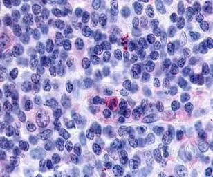 Anti-GPR65 antibody used in IHC (Paraffin sections) (IHC-P). GTX70561