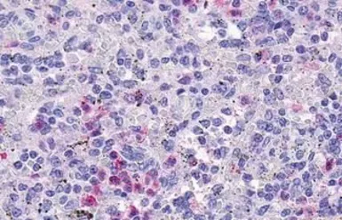 Anti-GPCR HM74 antibody used in IHC (Paraffin sections) (IHC-P). GTX70581