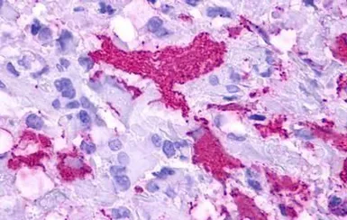 Anti-GPR84 antibody used in IHC (Paraffin sections) (IHC-P). GTX70841