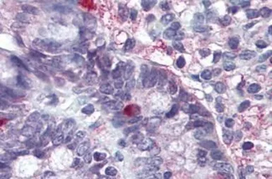 Anti-LGR5 antibody used in IHC (Paraffin sections) (IHC-P). GTX71143