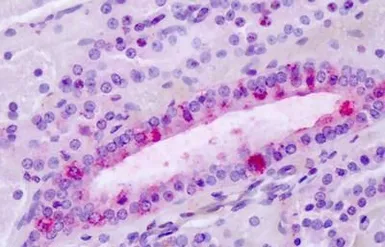Anti-Latrophilin 3 antibody used in IHC (Paraffin sections) (IHC-P). GTX71183