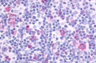 Anti-Prostaglandin I2 Receptor antibody used in IHC (Paraffin sections) (IHC-P). GTX71509