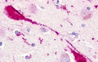 Anti-CMKLR1 antibody used in IHC (Paraffin sections) (IHC-P). GTX71519