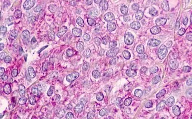 Anti-CMKLR1 antibody used in IHC (Paraffin sections) (IHC-P). GTX71519