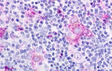 Anti-CMKLR1 antibody used in IHC (Paraffin sections) (IHC-P). GTX71519