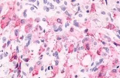 Anti-mGluR6 antibody used in IHC (Paraffin sections) (IHC-P). GTX71531