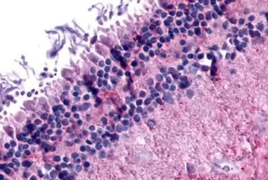 Anti-mGluR6 antibody used in IHC (Paraffin sections) (IHC-P). GTX71531