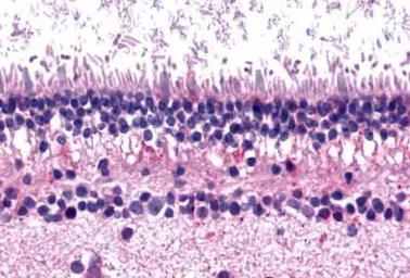 Anti-mGluR6 antibody used in IHC (Paraffin sections) (IHC-P). GTX71531
