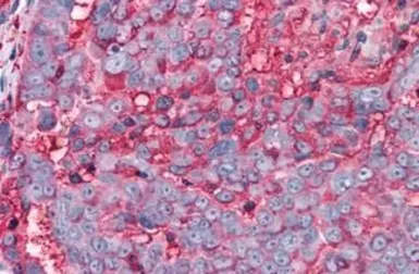 Anti-TAS1R3 antibody used in IHC (Paraffin sections) (IHC-P). GTX71575