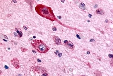 Anti-GABA B Receptor 1 antibody used in IHC (Paraffin sections) (IHC-P). GTX71591