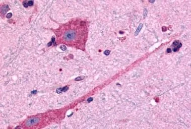 Anti-Dopamine Receptor D2 antibody used in IHC (Paraffin sections) (IHC-P). GTX71747